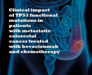 tumore colon Immagine del colon con titolo della ricerca